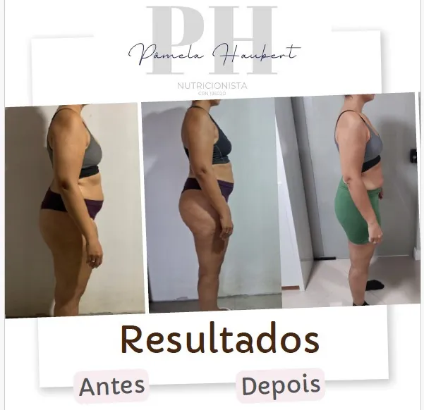 Antes e depois de paciente acompanhada pela Pâmela Haubert