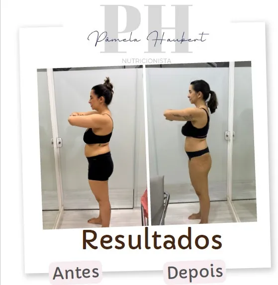 Antes e depois de paciente acompanhada pela Pâmela Haubert