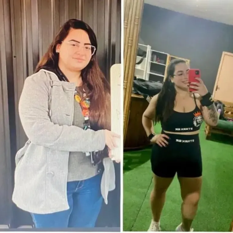 Antes e depois de paciente acompanhada pela Pâmela Haubert
